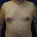 PATIENT 67 Before