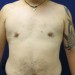 PATIENT 67 After