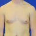 PATIENT 73 Before
