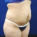 PATIENT 123 Before