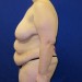 PATIENT 173 Before - 3