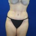 PATIENT 219 After