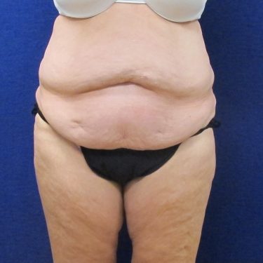 Weight loss shake safe for breastfeeding photo 4