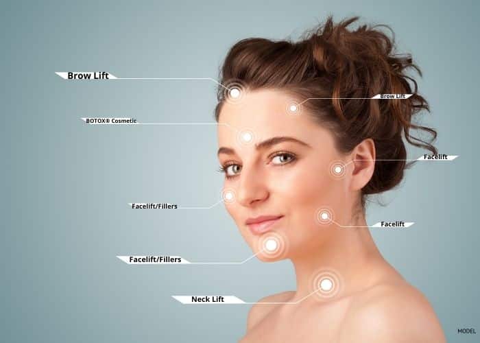 Woman's face with labels to the different facial areas, telling which plastic surgery procedures could address that area.