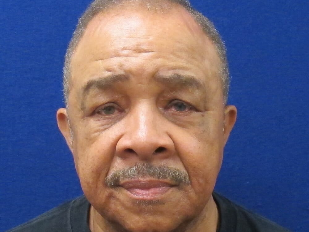 Case--9786 | Before Blepharoplasty