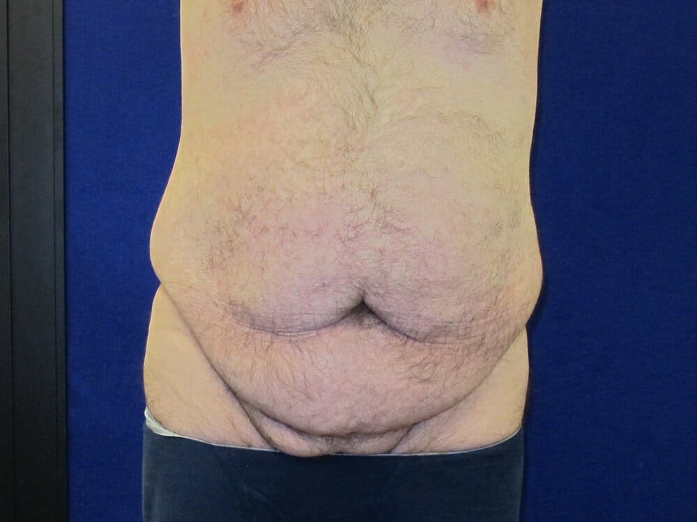 Case--3709 | Before Body