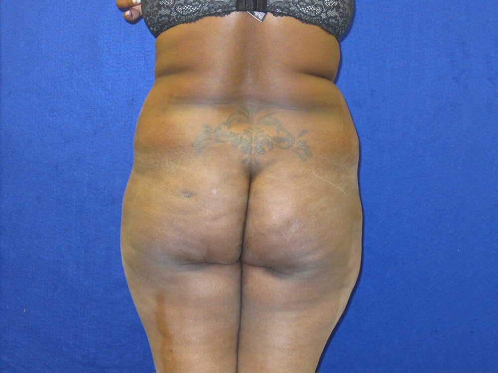 Case--9866 | Before Body