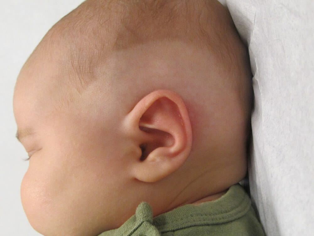 Case--2360 | After EarWell™