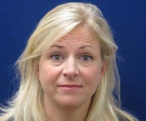 Case--6704 | Before Injectables