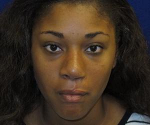 Case--3318 | After Face